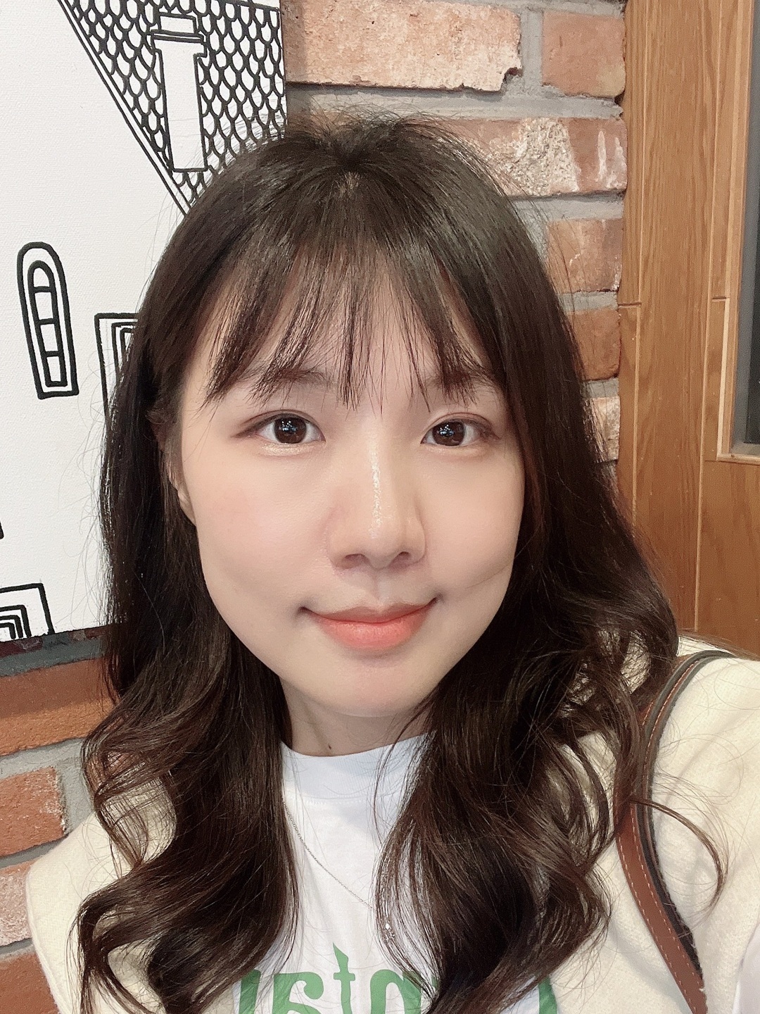 Before Facial Contouring Case 2