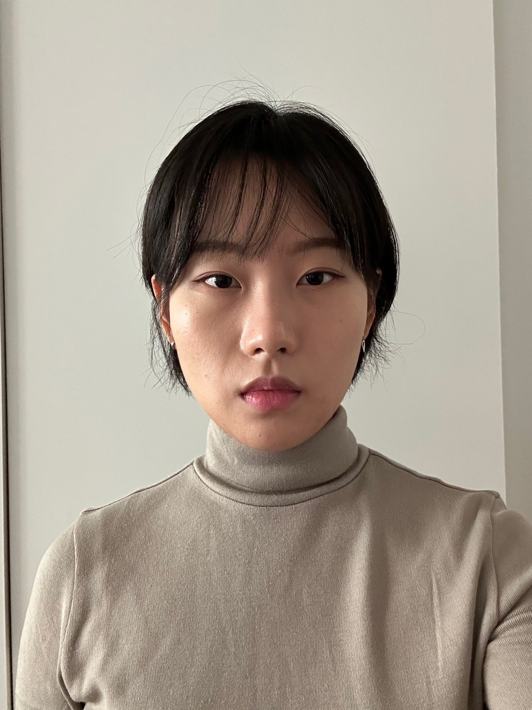 After Facial Contouring Case 1
